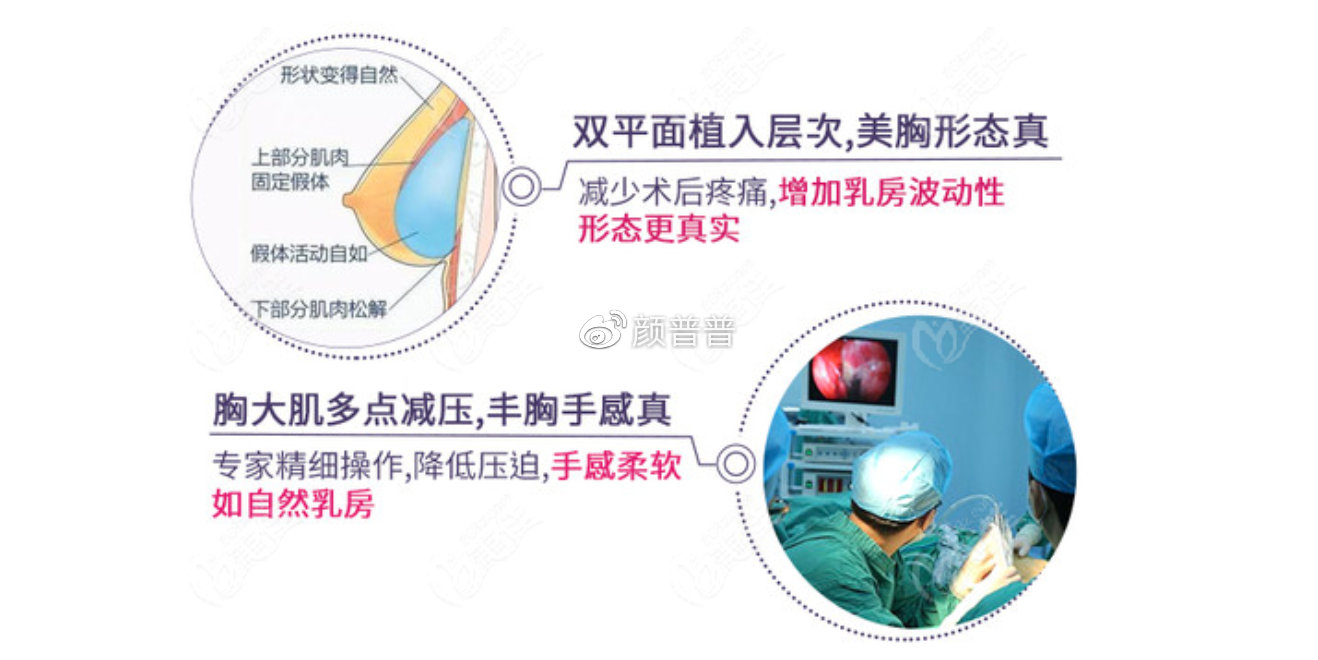丰胸，如何选择最佳的整形医院