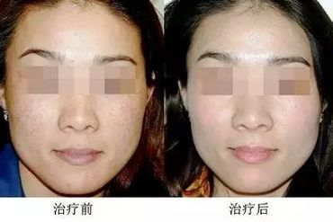 简洁明了