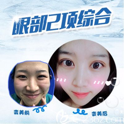 九院隆鼻价格详解，专业与信誉并重