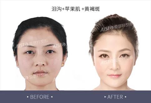 张冰洁整形，重塑美丽的艺术之旅