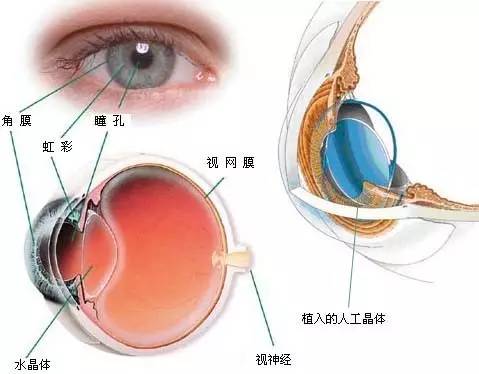 人工晶体十大排名及详细解析