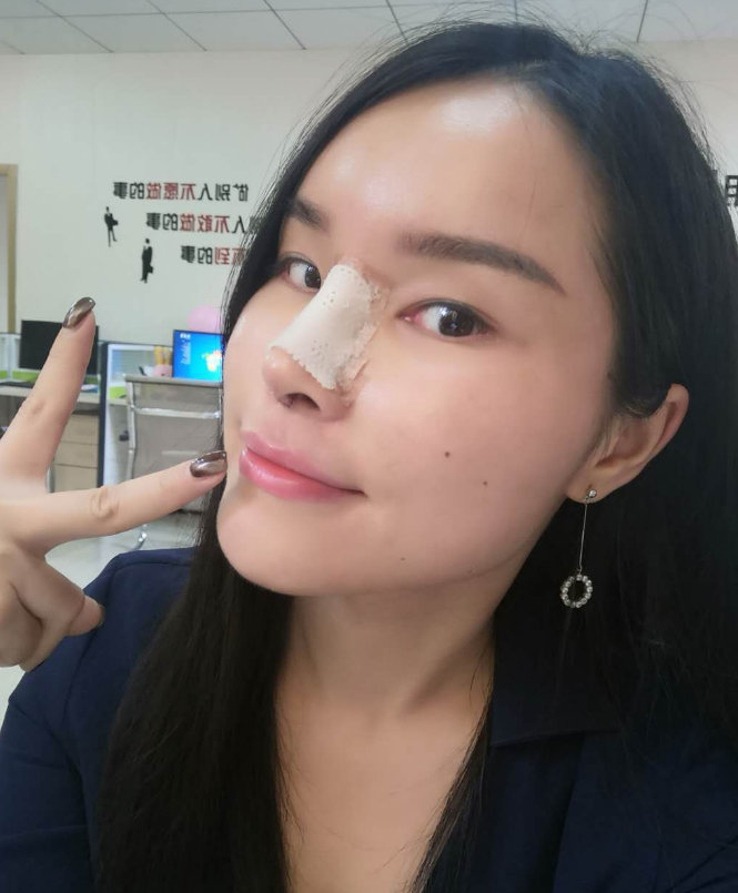 隆鼻手术