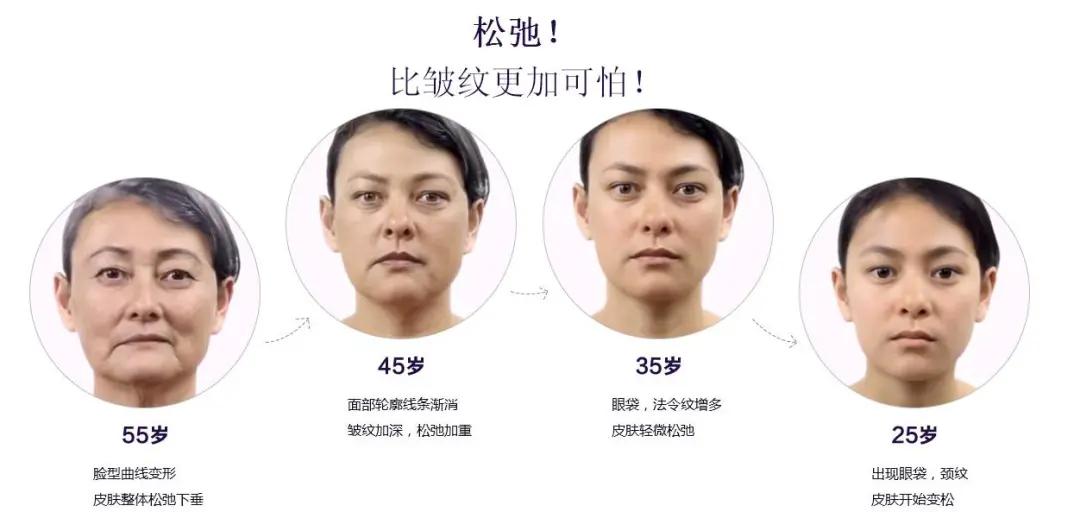 光子嫩肤，如何选择最佳的美容场所