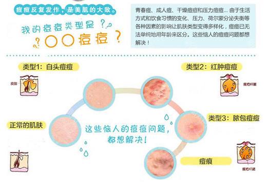 彩光祛痘需要多少钱？全面解析彩光祛痘费用因素