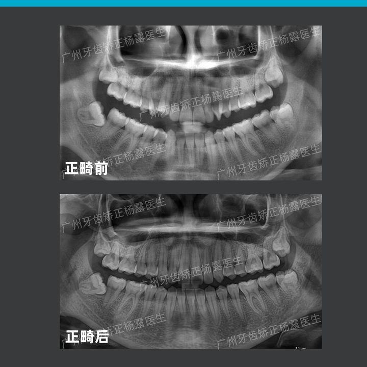 广州整牙医院，专业口腔医疗的典范